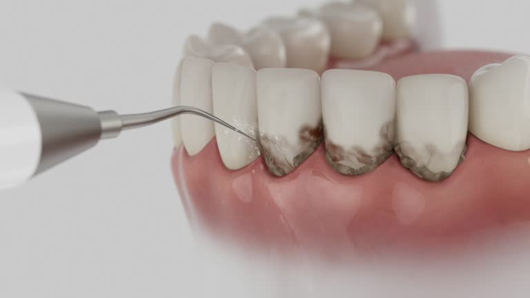 Reliable Dental Implants contractor in Whitehall, OH by Smile Center Dentistry